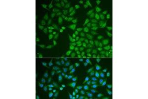Immunofluorescence analysis of U2OS cells using PNLIP Polyclonal Antibody (PNLIP 抗体)