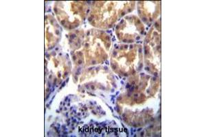 TRPM6(CHAK2) Antibody immunohistochemistry analysis in formalin fixed and paraffin embedded human kidney tissue followed by peroxidase conjugation of the secondary antibody and DAB staining. (TRPM6 抗体  (AA 317-348))