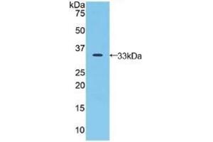 Detection of Recombinant JAG2, Human using Polyclonal Antibody to Jagged 2 Protein (JAG2) (JAG2 抗体  (AA 714-981))