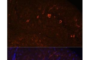 Immunofluorescence analysis of Mouse brain using KAL1 Polyclonal Antibody at dilution of 1:100. (KAL1 抗体)