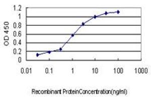 Detection limit for recombinant GST tagged PSMB2 is approximately 0.