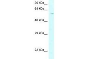Image no. 1 for anti-Prolyl 4-Hydroxylase, alpha Polypeptide II (P4HA2) (AA 289-338) antibody (ABIN6747697) (P4HA2 抗体  (AA 289-338))