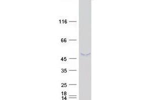 Western Blotting (WB) image for Sad1 and UNC84 Domain Containing 3 (SUN3) (Transcript Variant 2) protein (Myc-DYKDDDDK Tag) (ABIN2732987)
