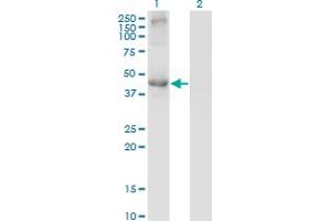Western Blot analysis of TCN2 expression in transfected 293T cell line by TCN2 monoclonal antibody (M01), clone 2F4. (TCN2 抗体  (AA 1-400))
