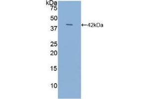 Detection of Recombinant NT-ProANP, Human using Polyclonal Antibody to N-Terminal Pro-Atrial Natriuretic Peptide (NT-ProANP) (PRO-ANP 抗体  (AA 25-123))