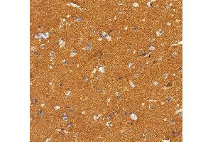 IHC analysis of NSF using anti-NSF antibody (ABIN7601630). (NSF 抗体  (AA 4-636))