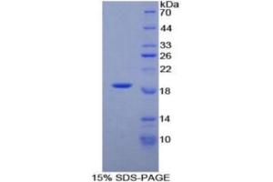 Western Blotting (WB) image for Phospholipase A2-Activating Protein (PLAA) ELISA Kit (ABIN6730908)