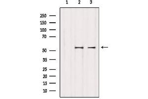 Western blot analysis of extracts from various samples, using Keratin 8 Antibody.