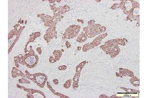 Image no. 1 for anti-Keratin 20 (KRT20) antibody (ABIN335316) (KRT20 抗体)