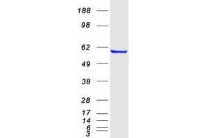Validation with Western Blot