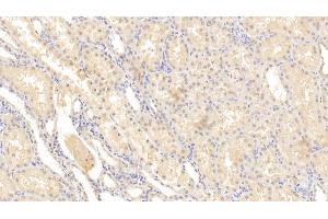 Detection of MMP2 in Human Kidney Tissue using Monoclonal Antibody to Matrix Metalloproteinase 2 (MMP2) (MMP2 抗体  (AA 110-660))