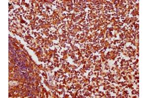 IHC image of ABIN7148413 diluted at 1:200 and staining in paraffin-embedded human lymph node tissue performed on a Leica BondTM system.
