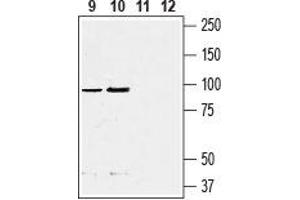 Western blot analysis of rat (lanes 9 and 11)  and mouse (lanes 10 and 12)  fat tissue lysate:9, 10.