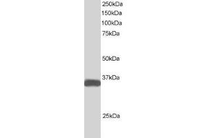 Western Blotting (WB) image for anti-STE20-Related Kinase Adaptor beta (STRADB) (C-Term) antibody (ABIN184938)