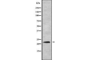 Western blot analysis of RAB22A using HT29 whole cell lysates (RAB22A 抗体  (C-Term))