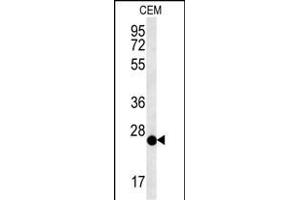 CRISPLD2 Antibody (N-term) (ABIN651759 and ABIN2840390) western blot analysis in CEM cell line lysates (15 μg/lane). (CRISPLD2 抗体  (N-Term))