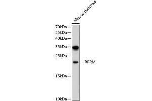 Western blot analysis of extracts of mouse pancreas, using RPRM antibody (ABIN6133164, ABIN6147189, ABIN6147190 and ABIN6214113) at 1:1000 dilution. (Reprimo 抗体  (AA 1-109))