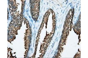 Immunohistochemical staining of paraffin-embedded prostate tissue using anti-DNTTIP1 mouse monoclonal antibody.