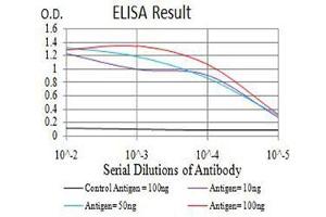 Black line: Control Antigen (100 ng),Purple line: Antigen (10 ng), Blue line: Antigen (50 ng), Red line:Antigen (100 ng) (ADAMTS1 抗体  (AA 858-960))