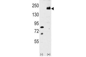 Western blot analysis of LRP6 antibody and 293 cell lysate either nontransfected or transiently transfected with the LRP6 gene. (LRP6 抗体  (AA 1531-1560))