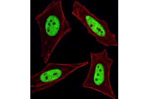 Fluorescent image of HeLa cells stained with Cellular Apoptosis Susceptibility Antibody (N-term) (ABIN1882070 and ABIN2838356). (CSE1L 抗体  (N-Term))
