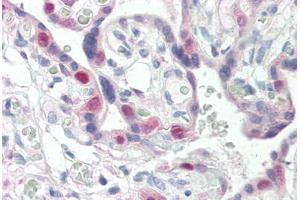 Human Placenta (formalin-fixed, paraffin-embedded) stained with CDK2 antibody ABIN337209 at 5 ug/ml followed by biotinylated anti-mouse IgG secondary antibody ABIN481714, alkaline phosphatase-streptavidin and chromogen. (CDK2 抗体)