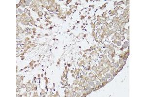 Immunohistochemistry of paraffin-embedded Rat testis using OPRK1 Polyclonal Antibody at dilution of 1:100 (40x lens). (OPRK1 抗体)