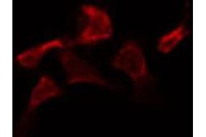 ABIN6273998 staining HepG2 by IF/ICC. (Caspase 2 抗体  (Internal Region))