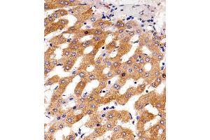 Immunohistochemical analysis of raffin-embedded H. (Phenylalanine Hydroxylase 抗体  (AA 127-161))
