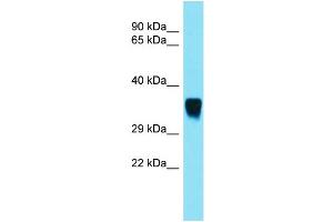 Host: Rabbit  Target Name: Snx15  Sample Tissue: Rat Muscle lysates  Antibody Dilution: 1. (SNX15 抗体  (C-Term))