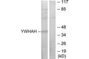 Western blot analysis of extracts from Jurkat cells, using 14-3-3 eta Antibody. (14-3-3 eta 抗体  (AA 51-100))