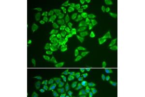 Immunofluorescence analysis of A549 cells using KEAP1 Polyclonal Antibody