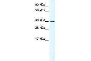 Western Blotting (WB) image for anti-Transient Receptor Potential Cation Channel, Subfamily M, Member 3 (TRPM3) (N-Term) antibody (ABIN2774683)