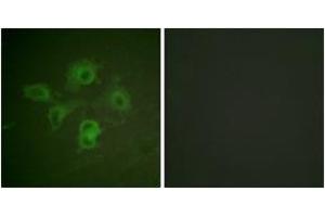 Immunofluorescence analysis of HuvEc cells, using EPHB1/2 (Phospho-Tyr594/604) Antibody. (EPHB1/2 抗体  (pTyr594))