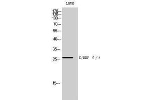 Western Blotting (WB) image for anti-C/EBP delta/epsilon (C-Term) antibody (ABIN3183580) (C/EBP delta/epsilon (C-Term) 抗体)
