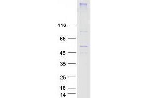Western Blotting (WB) image for Solute Carrier Family 2 (Facilitated Glucose Transporter) Member 8 (SLC2A8) protein (Myc-DYKDDDDK Tag) (ABIN2721996)