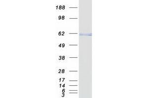 Validation with Western Blot