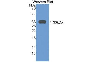 Western blot analysis of the recombinant protein. (Plexin A1 抗体  (AA 43-300))