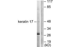 Western blot analysis of extracts from HuvEc cells, using keratin 17 antibody (ABIN5976437). (KRT17 抗体  (C-Term))