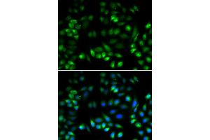 Immunofluorescence analysis of U2OS cells using MANF antibody (ABIN5974212). (MANF 抗体)