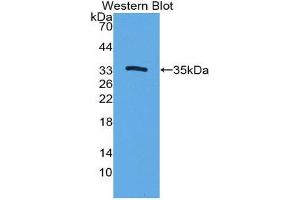 Western Blotting (WB) image for anti-Cytochrome P450, Family 7, Subfamily A, Polypeptide 1 (CYP7A1) (AA 109-383) antibody (ABIN1862411) (CYP7A1 抗体  (AA 109-383))