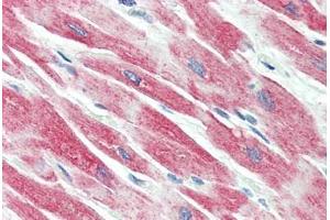 Human Heart (formalin-fixed, paraffin-embedded) stained with BECN1 antibody ABIN461894 at 2. (Beclin 1 抗体  (C-Term))