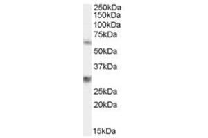 Image no. 1 for anti-Membrane Protein, Palmitoylated 6 (MAGUK P55 Subfamily Member 6) (MPP6) (N-Term) antibody (ABIN374387) (MPP6 抗体  (N-Term))
