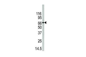 Western Blotting (WB) image for anti-Peptidyl Arginine Deiminase, Type IV (PADI4) (AA 512-544), (C-Term) antibody (ABIN389125)