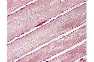 Anti-GLUT4 antibody IHC of human skeletal muscle. (GLUT4 抗体  (AA 498-509))