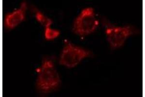ABIN6277182 staining A549 cells by IF/ICC. (Dynamitin 抗体  (C-Term))
