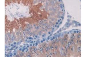 Detection of SDH in Rat Testis Tissue using Polyclonal Antibody to Sorbitol Dehydrogenase (SDH) (SORD 抗体  (AA 2-357))