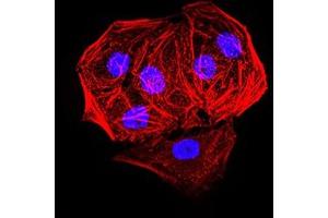 Immunofluorescence analysis of Hela cells.