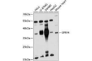 Western blot analysis of extracts of various cell lines, using SPRY4 antibody (ABIN6132548, ABIN6148395, ABIN6148396 and ABIN6221865) at 1:1000 dilution. (SPRY4 抗体  (AA 30-210))