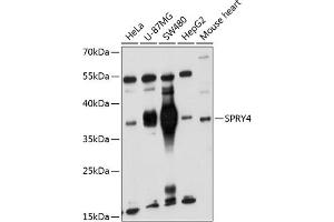 Western blot analysis of extracts of various cell lines, using SPRY4 antibody (ABIN6132548, ABIN6148395, ABIN6148396 and ABIN6221865) at 1:1000 dilution. (SPRY4 抗体  (AA 30-210))